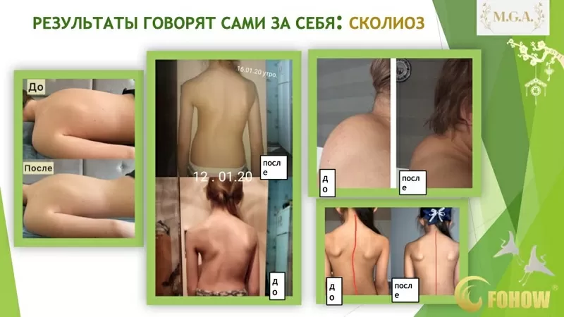  СЕАНС БИОЭНЕРГОМАССАЖА FOHOW 2